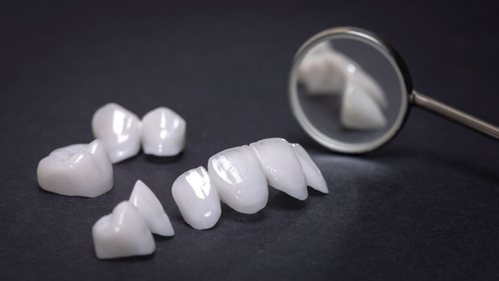 Estética dental en Villarrobledo