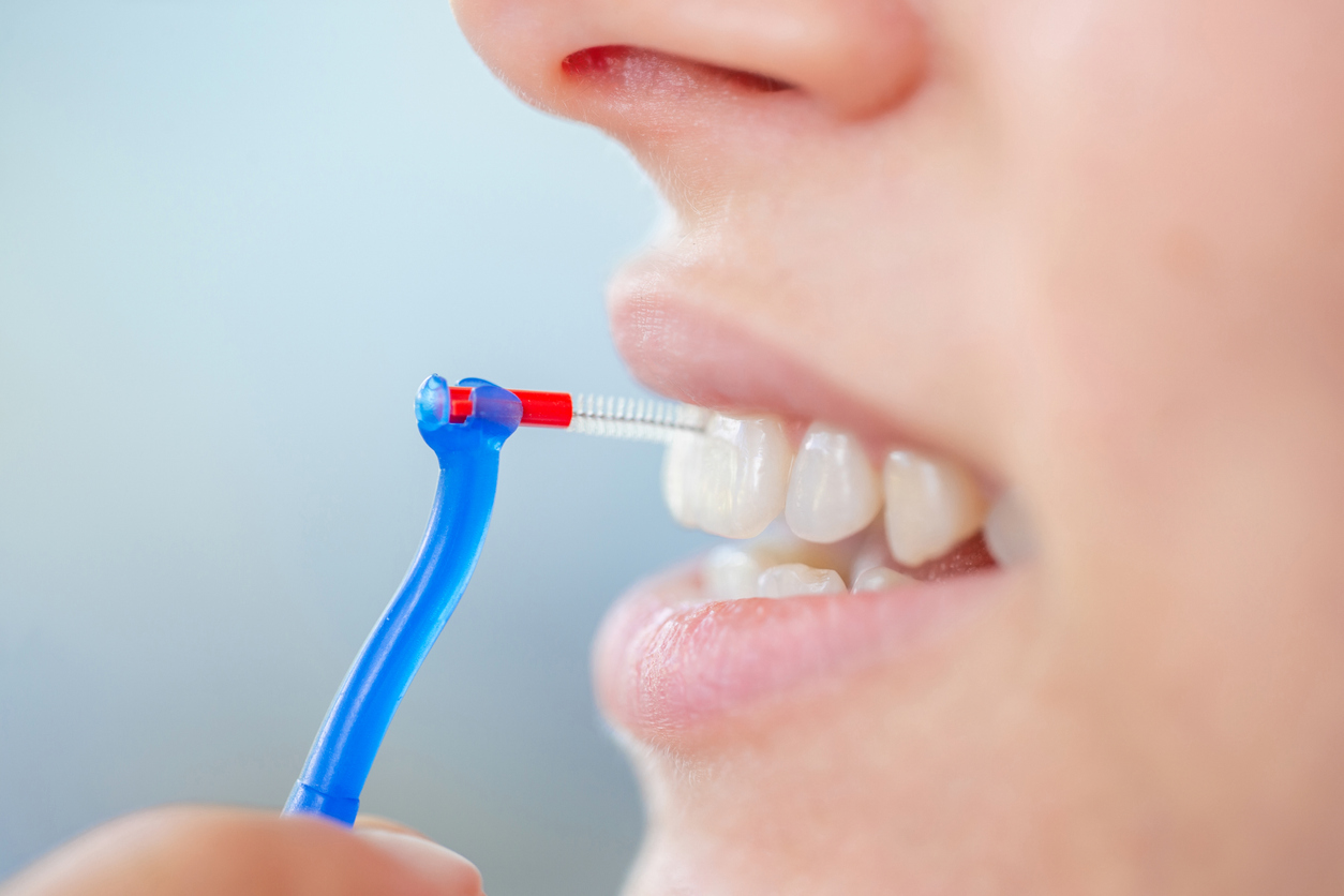 higiene interdental
