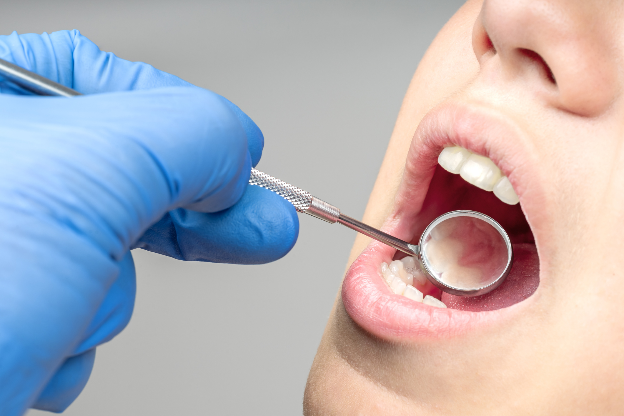 cuidar la salud oral tras el verano