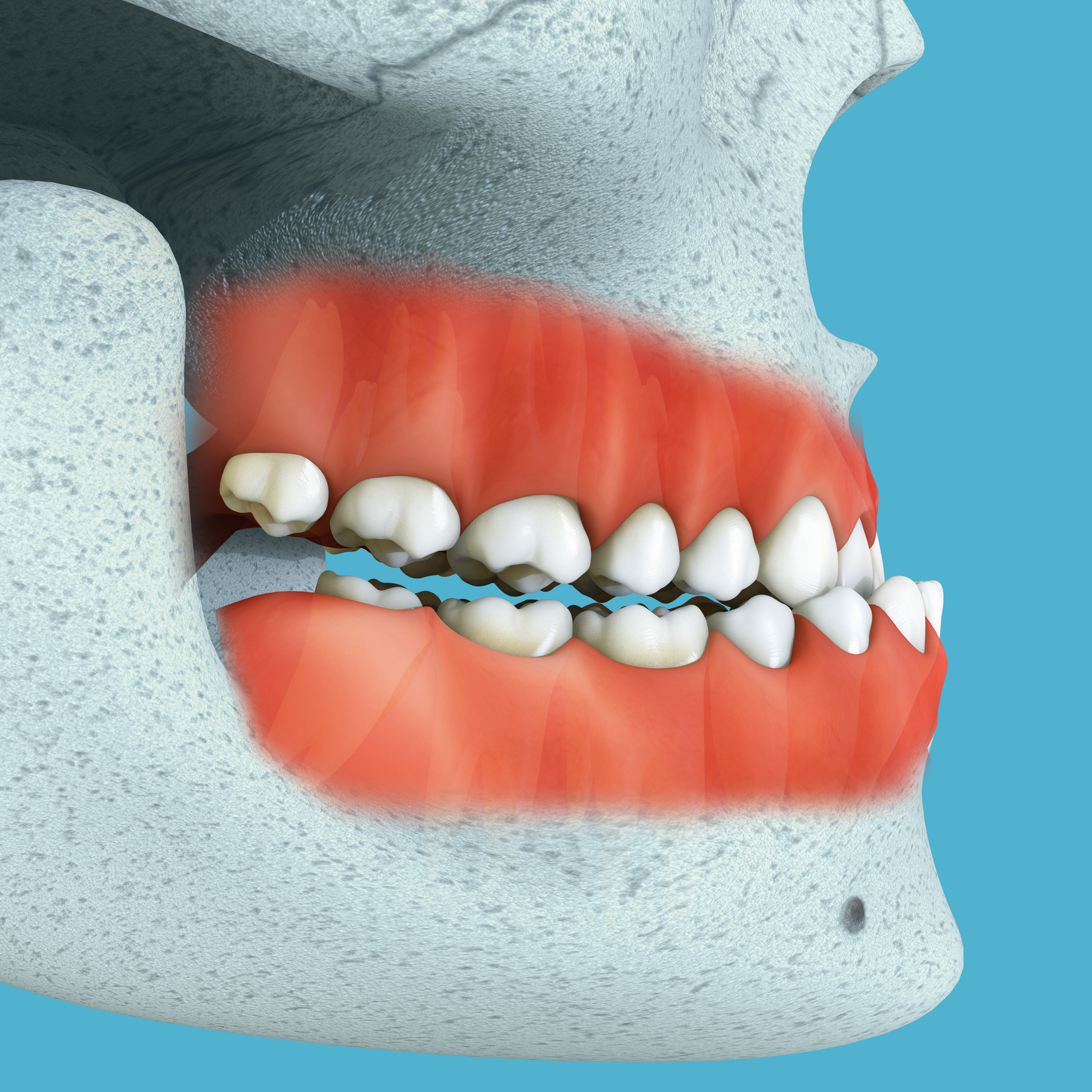 maloclusiones dentales